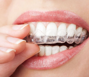 teeth